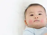 Chẩn đoán và điều trị dị ứng đạm sữa bò (publications)