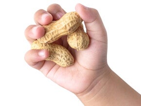 Can thiệp dinh dưỡng trong phòng ngừa tình trạng dị ứng (publications)