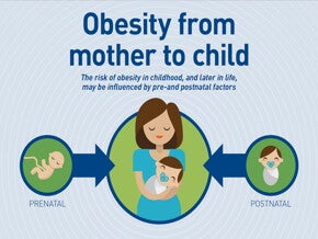 Béo phì ở người mẹ và trẻ em (infographics)