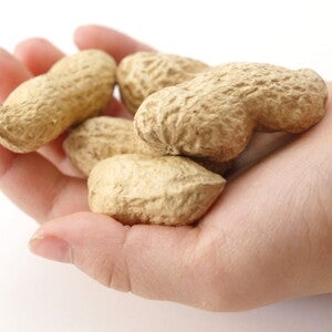 Phương pháp ngăn ngừa dị ứng đậu phộng là an toàn trên phương diện dinh dưỡng (news)